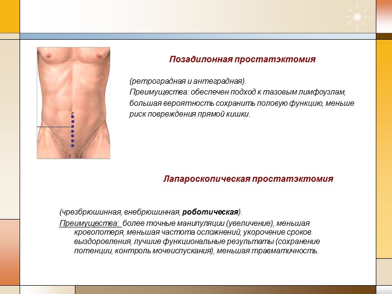 Позадилонная простатэктомия  (ретроградная и антеградная).  Преимущества: обеспечен подход к тазовым лимфоузлам, большая